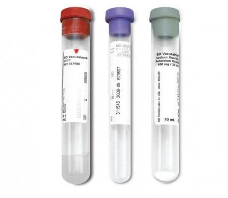 Citrate sodique d'anticoagulant   Tubes de collection de sang de guide de couleur de fluorure de sodium fournisseur